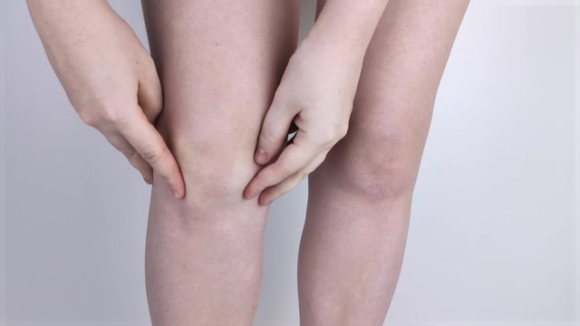 A woman suffers from knee pain. Examination by an orthopedist and traumatologist. Redness and swelling of the legs, torn meniscus or knee bursitis
