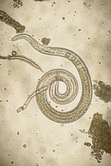 Trichinella spiralis - parasitic nematoda worm microscope