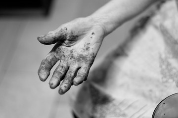Mano nudosa con artrosis de una anciana manchada de pimentón, blanco y negro. Tomada el 28 de febrero de 2020 en Burgos.