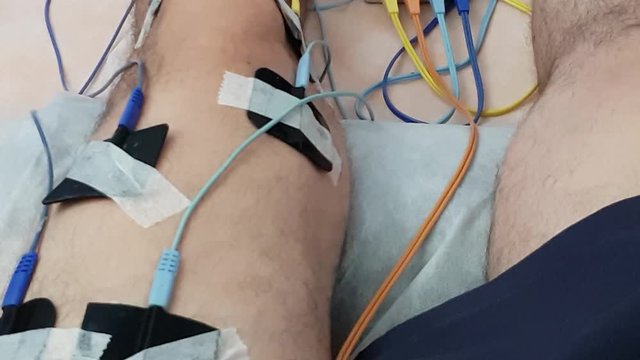 Electrostimulation of the quadriceps as a physiotherapy therapy, 4K video