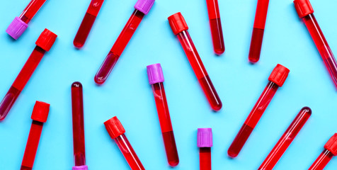 Blood in test tubes on blue background.
