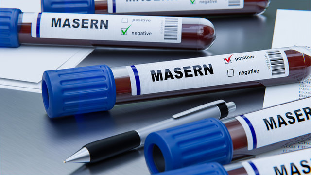 positiver Bluttest Masern Virus im Labor, Nachweis von Antik&ouml;rper
