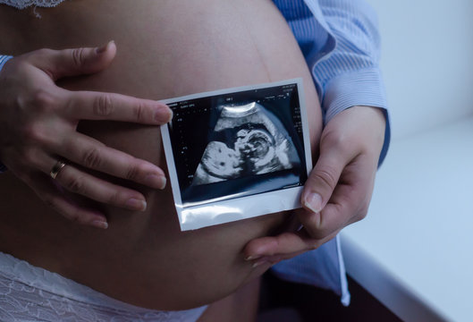 pregnant woman holding ultrasound scan