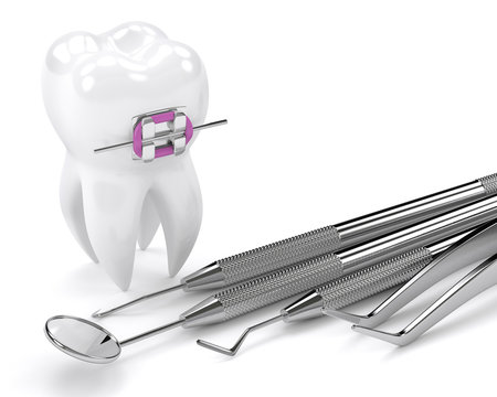 3d render of tooth with braces and dental diagnostic instruments