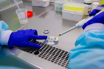 In vitro fertilization laboratory biotechnology sperm cells analysis 
