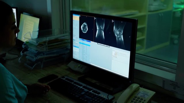 Medical specialist examining patient's bones on monitor. Female doctor is looking at scans of a patient on computer screen in clinic.