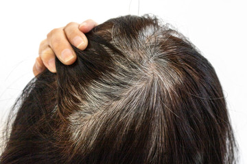 Obraz premium 染めた後に生えてきた白髪の高齢女性の頭