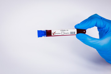 Hand holds a test tube containing a blood positive sample, test tube with blood for Covid-19 (coronavirus) analyzing. Laboratory testing patient’s blood. Blue nitrile glove.