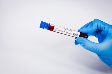 Hand holds a test tube containing a blood negative sample, test tube with blood for Covid-19 (coronavirus) analyzing. Laboratory testing patient’s blood. Blue nitrile glove.