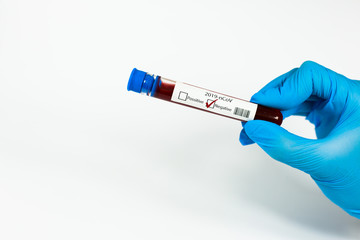 Hand holds a test tube containing a blood negative sample, test tube with blood for Covid-19 (coronavirus) analyzing. Laboratory testing patient’s blood. Blue nitrile glove.
