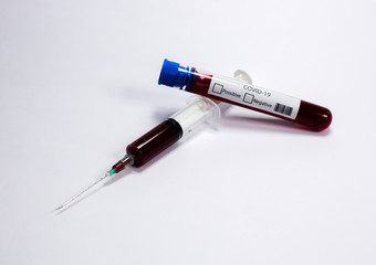 Test tube with blood sample Covid-19 (coronavirus). Laboratory blood test. syringe with blood. 
Covid-19 (coronavirus) test tubes.