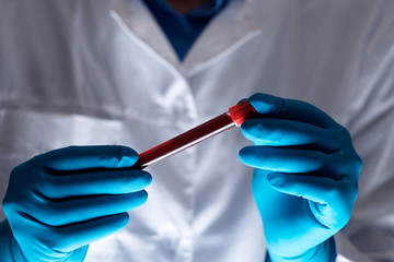 Coronavirus 2019-nCoV Blood Sample.