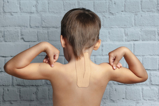 Child athlete with teips on his back. Treatment of spine, back problems, scoliosis. 