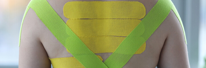 Female wearing kinesio tapes at her back and shoulders at doctor office