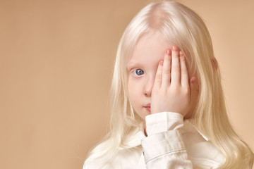 Albino. Cute caucasian little girl with albinism syndrome, she closed one eye and look at camera....