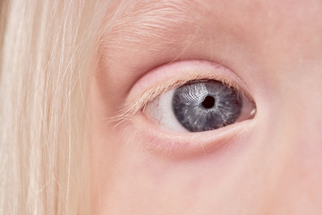 close-up mystic photo of albino child eye, kid girl with unusual eyes color. natural beauty, albinism concept