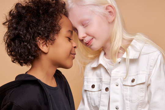 diverse black and albino kids in love, they have tender feeling for each other, people with unusual hair and skin color