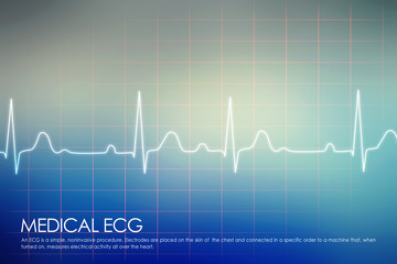 Heart with cardiogram -2D illustration

