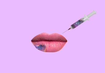 Injection on the lips. Silicone in the lips. Hyaluronic acid in a syringe. Bruise on the lips. Victim of cosmetology.