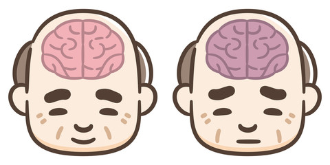 脳　シニア男性