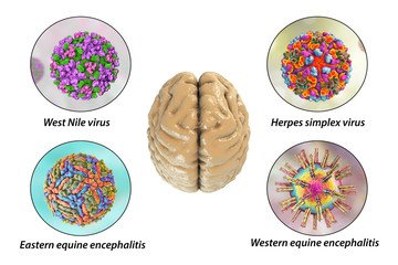 Microorganisms that cause brain infections