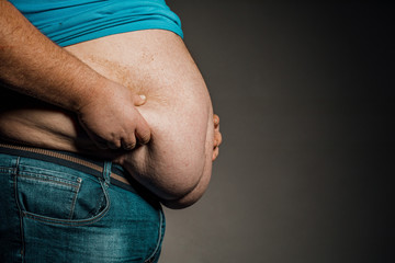 Overweight of a person's body with hands touching the abdomen. The concept of obesity - obrazy, fototapety, plakaty