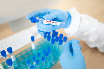 Medical scientist hand with blue sterile rubber gloves holding COVID-19 test tube in hospital laboratory. Male doctor or physician getting result of Coronavirus case. 2019-nCoV lab test concept