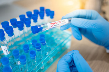 Medical scientist hand with blue sterile rubber gloves holding COVID-19 test tube in hospital...