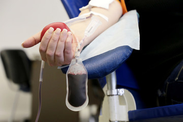 Woman blood donor in chair during donation with a blood bag and red bouncy ball in hand. Concept of donorship, transfusion, health care