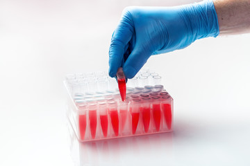 doctor epidemiologist holding tube with samples for pcr test for detect SARS-nCOV-2 virus /...