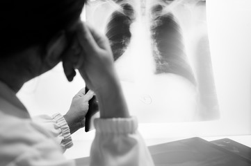 Woman doctor looking patient chest x-ray film before treatment.Image lung at radiology department in hospital.Covid-19 scan body xray test detection for covid virus epidemic spread concept.