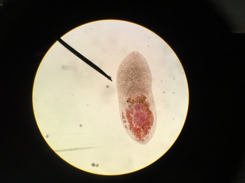 Haplorchis taichui 