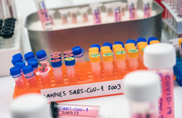 Vials with samples of SARS-COV-1 in a research laboratory, conceptual image