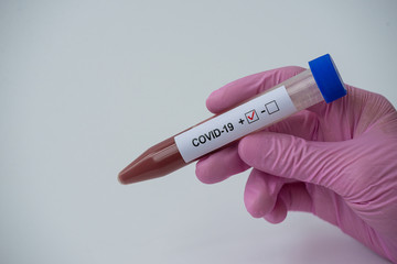 A hand holding a tube with blood positive COVID-19. Coronavirus test. horizontal orientation. White background.