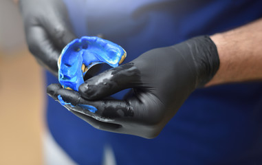 Dentist doctor holds a dental cast in his hands. Doctor holds a teeth imprint