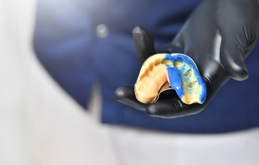 Dentist doctor holds a dental cast in his hands. Doctor holds a teeth imprint