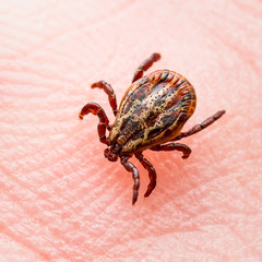 Infectious Encephalitis Tick Insect Crawling on Skin. Encephalitis Virus or Lyme Borreliosis Disease Infected Dermacentor Tick Arachnid Parasite Macro.