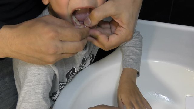 Father is trying to tear out his son&rsquo;s tooth, dad pulls out the baby&rsquo;s milk tooth at home