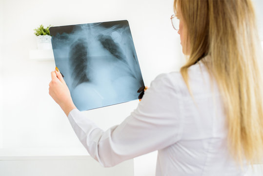 A young doctor doctor will erase a snapshot of the lungs. Diagnosis of pneumonia or tuberculosis. X-ray examination of the patient. Pacemaker on the heart