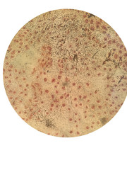 Laparoscopic biology experiment results