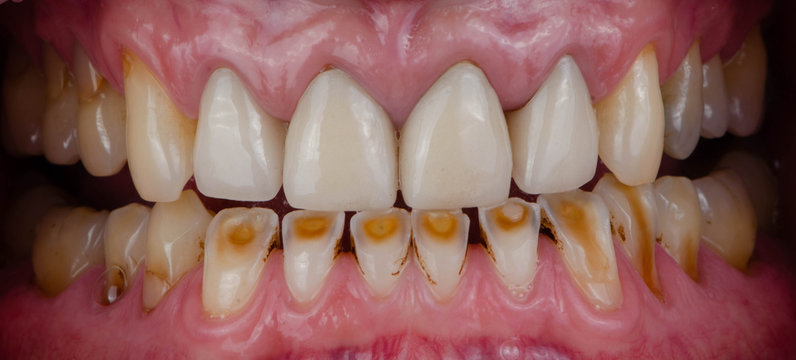 The various style of teeth