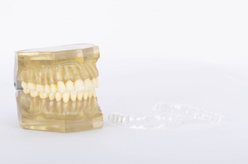 The many kinds of braces or orthodontic stuffs