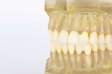 The dental model