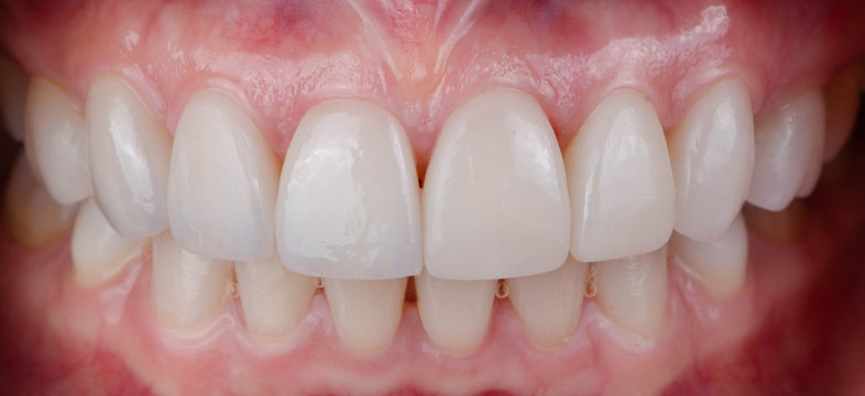 The various styles of intra-oral photograph