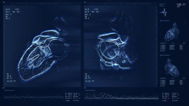 Heart scanning diagnostics 4K animation. Blood pressure, heart beat or rate monitoring. Health care equipment. Pulse measuring. Diagnosis of cardio diseases. Futuristic MRI, MRT, CT display or monitor
