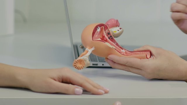 Gynecologist doctor consulting patient using uterus anatomy model