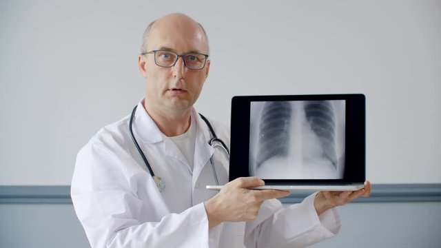 Practitioner doctor showing lung fluorography picture on laptop screen while online consultation. Pulmonologist showing x-ray picture with pulmonary pneumonia on remote reception