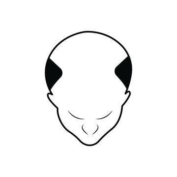 Hair loss color icon. Balding. Declining testosterone. Low T level sign. Alopecia, baldness. Men aging. Isolated vector illustration