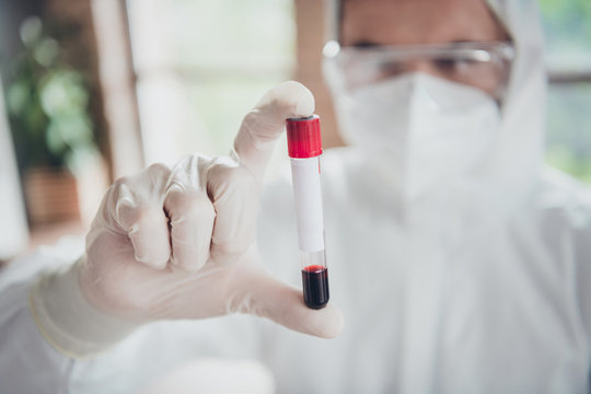 Closeup photo of corona virus blood probe sample medical test doc holding just collected tube examination covid flu cold patient wear face mask glasses gloves protective uniform indoors
