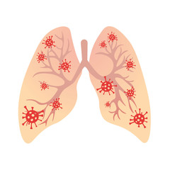 Viruses in lungs vector illustration. Concept of viral respiratory infection, coronavirus, bronchitis.